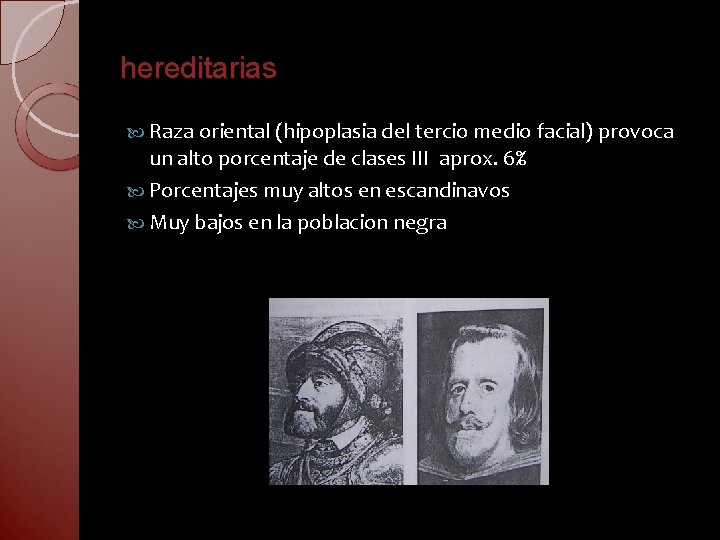 hereditarias Raza oriental (hipoplasia del tercio medio facial) provoca un alto porcentaje de clases