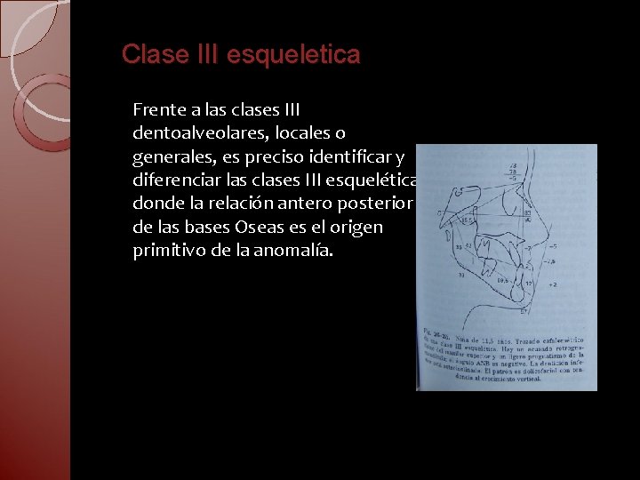 Clase III esqueletica Frente a las clases III dentoalveolares, locales o generales, es preciso