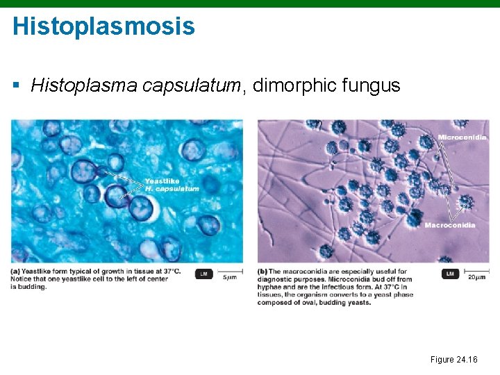 Histoplasmosis § Histoplasma capsulatum, dimorphic fungus Figure 24. 16 
