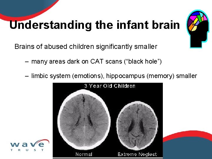 Understanding the infant brain Brains of abused children significantly smaller – many areas dark