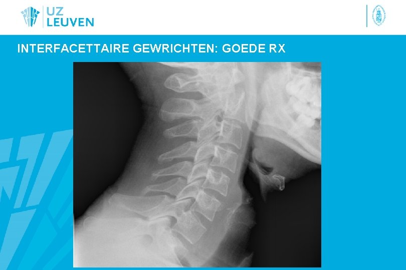 INTERFACETTAIRE GEWRICHTEN: GOEDE RX 