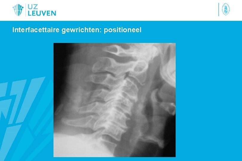 Interfacettaire gewrichten: positioneel 