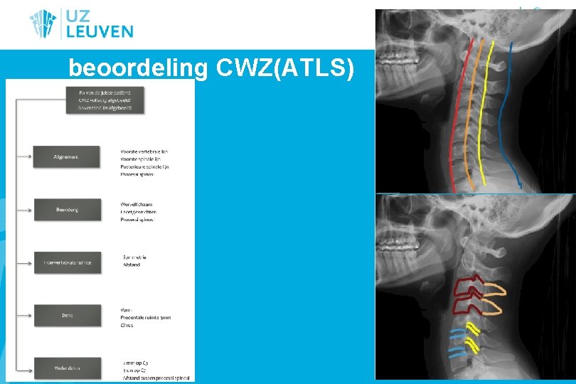 beoordeling CWZ(ATLS) 