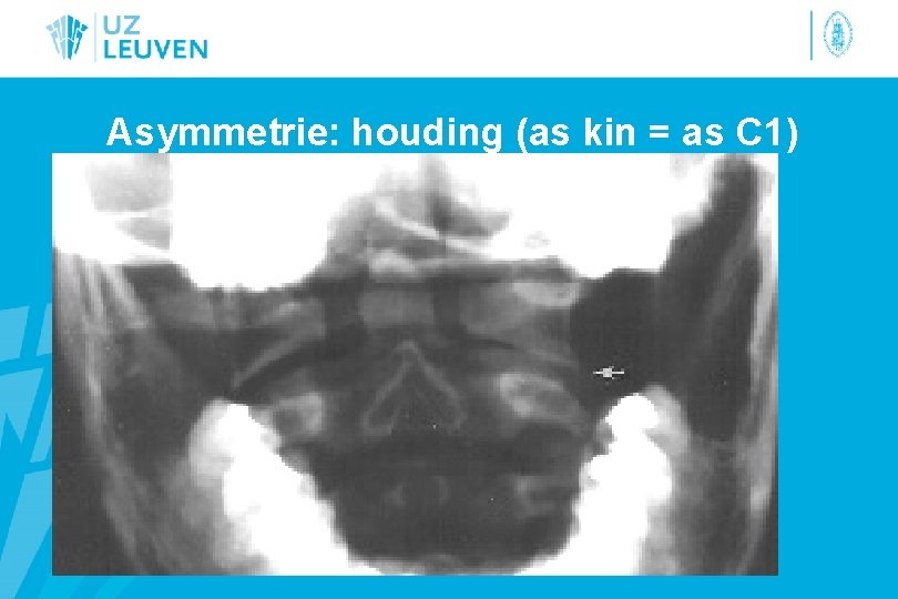 Asymmetrie: houding (as kin = as C 1) 