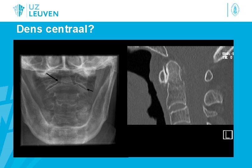 Dens centraal? 