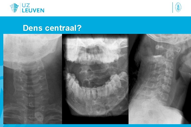 Dens centraal? 