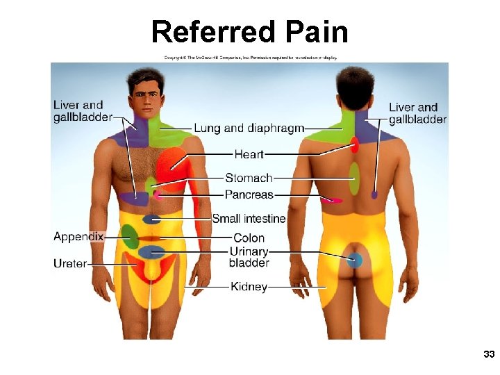 Referred Pain 33 