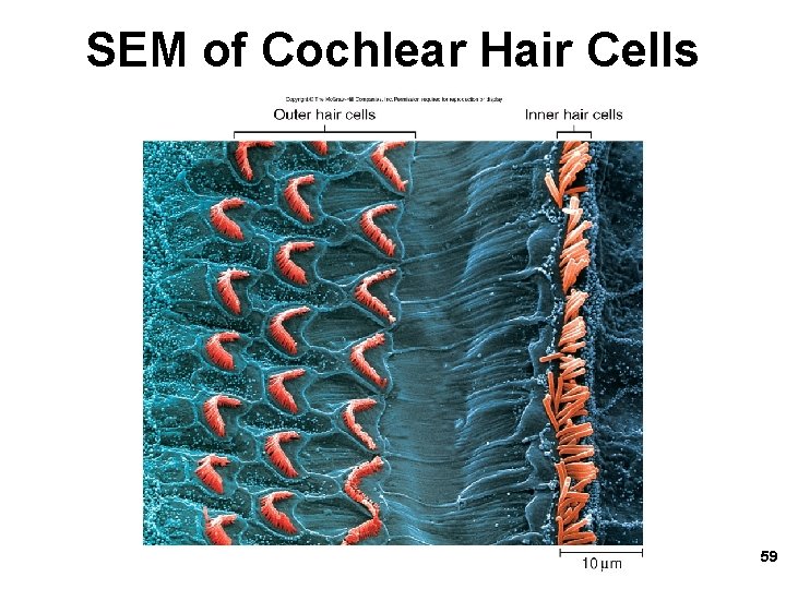 SEM of Cochlear Hair Cells 59 