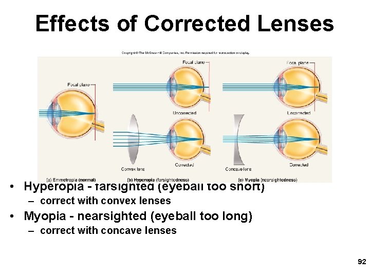 Effects of Corrected Lenses • Hyperopia - farsighted (eyeball too short) – correct with