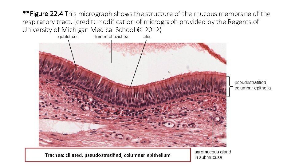 **Figure 22. 4 This micrograph shows the structure of the mucous membrane of the