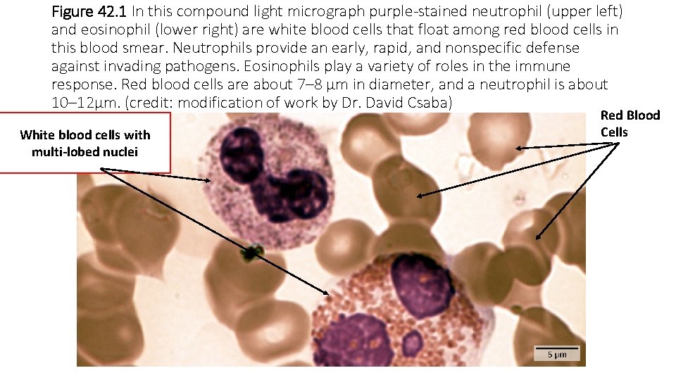 Figure 42. 1 In this compound light micrograph purple-stained neutrophil (upper left) and eosinophil