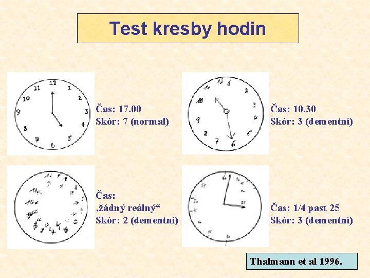 Test kresby hodin Čas: 17. 00 Skór: 7 (normal) Čas: 10. 30 Skór: 3