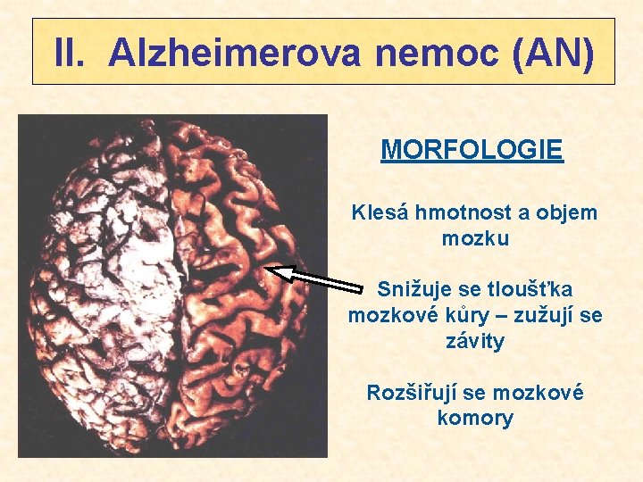 II. Alzheimerova nemoc (AN) MORFOLOGIE Klesá hmotnost a objem mozku Snižuje se tloušťka mozkové