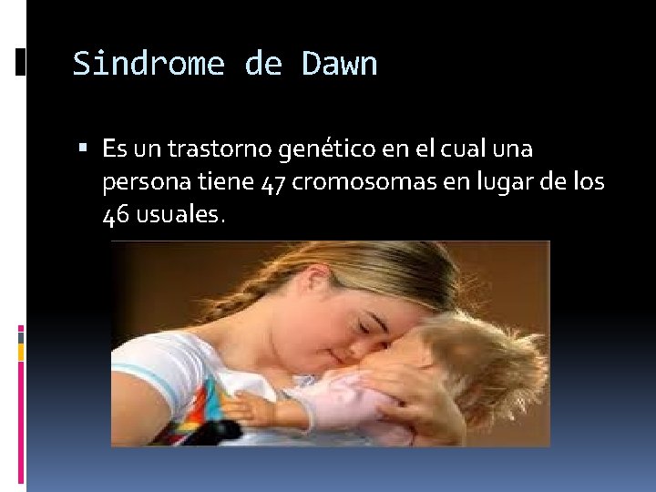 Sindrome de Dawn Es un trastorno genético en el cual una persona tiene 47