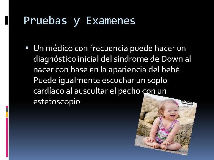 Pruebas y Examenes Un médico con frecuencia puede hacer un diagnóstico inicial del síndrome