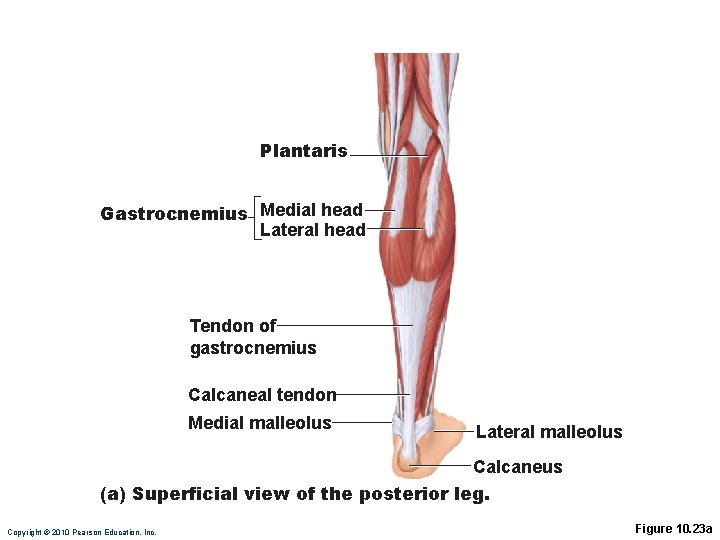 Plantaris Gastrocnemius Medial head Lateral head Tendon of gastrocnemius Calcaneal tendon Medial malleolus Lateral