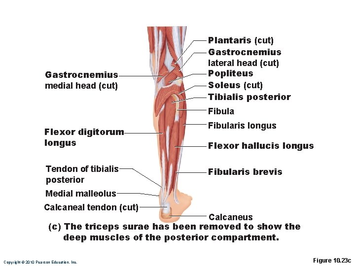 Gastrocnemius medial head (cut) Plantaris (cut) Gastrocnemius lateral head (cut) Popliteus Soleus (cut) Tibialis