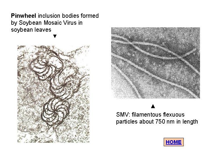 Pinwheel inclusion bodies formed by Soybean Mosaic Virus in soybean leaves ▼ ▲ SMV: