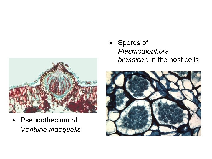  • Spores of Plasmodiophora brassicae in the host cells • Pseudothecium of Venturia