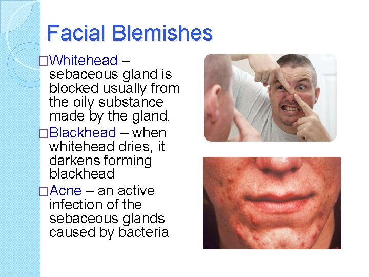 Facial Blemishes �Whitehead – sebaceous gland is blocked usually from the oily substance made