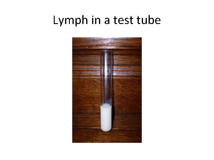 Lymph in a test tube Lymph in a test tube