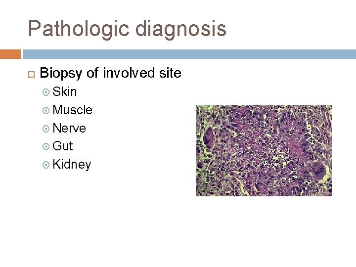 Pathologic diagnosis Biopsy of involved site Skin Muscle Nerve Gut Kidney 