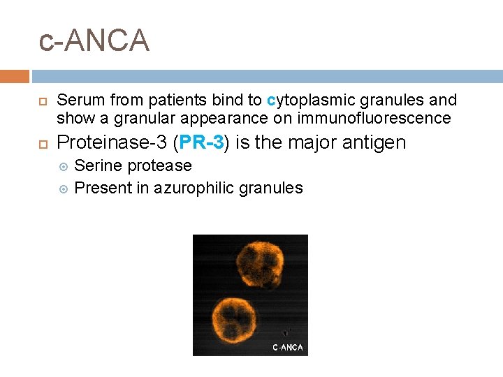 c-ANCA Serum from patients bind to cytoplasmic granules and show a granular appearance on