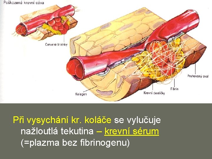 Při vysychání kr. koláče se vylučuje nažloutlá tekutina – krevní sérum (=plazma bez fibrinogenu)