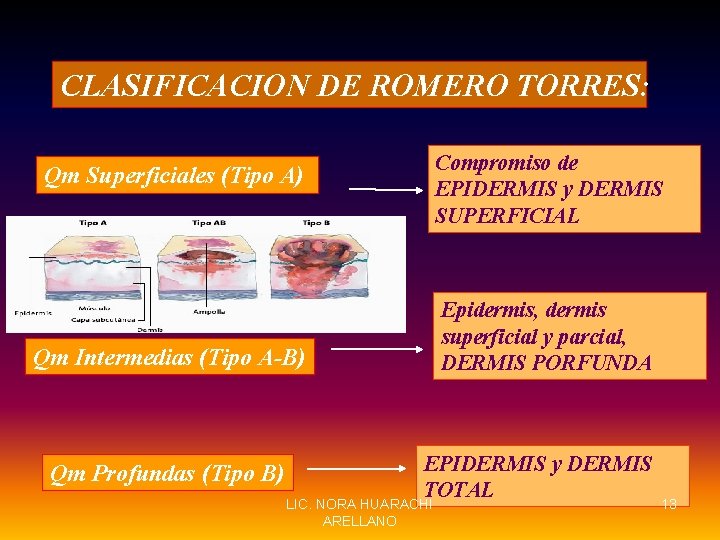 CLASIFICACION DE ROMERO TORRES: Compromiso de EPIDERMIS y DERMIS SUPERFICIAL Qm Superficiales (Tipo A)