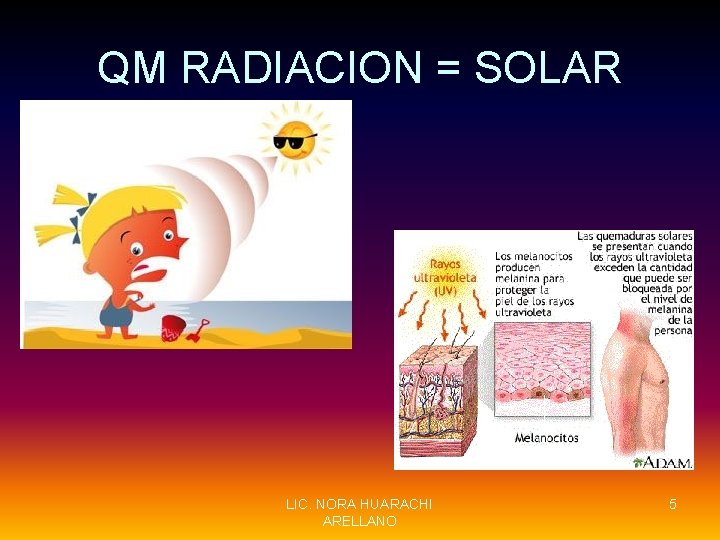 QM RADIACION = SOLAR LIC. NORA HUARACHI ARELLANO 5 