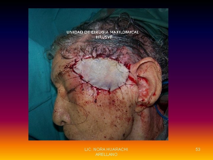 LIC. NORA HUARACHI ARELLANO 53 