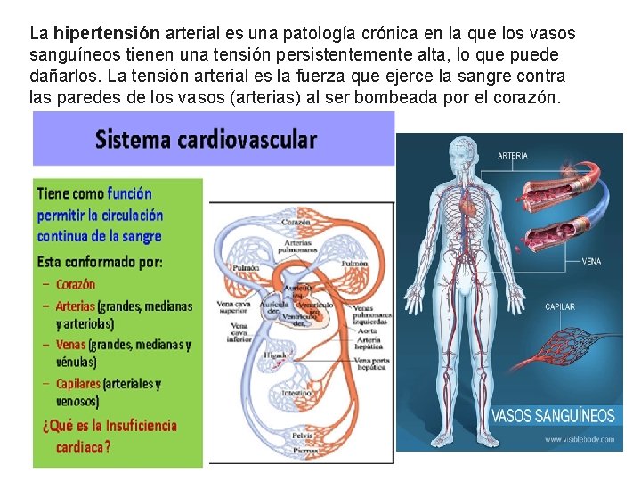La hipertensión arterial es una patología crónica en la que los vasos sanguíneos tienen