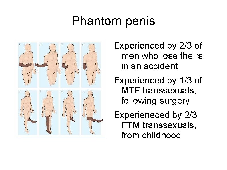 Phantom penis Experienced by 2/3 of men who lose theirs in an accident Experienced