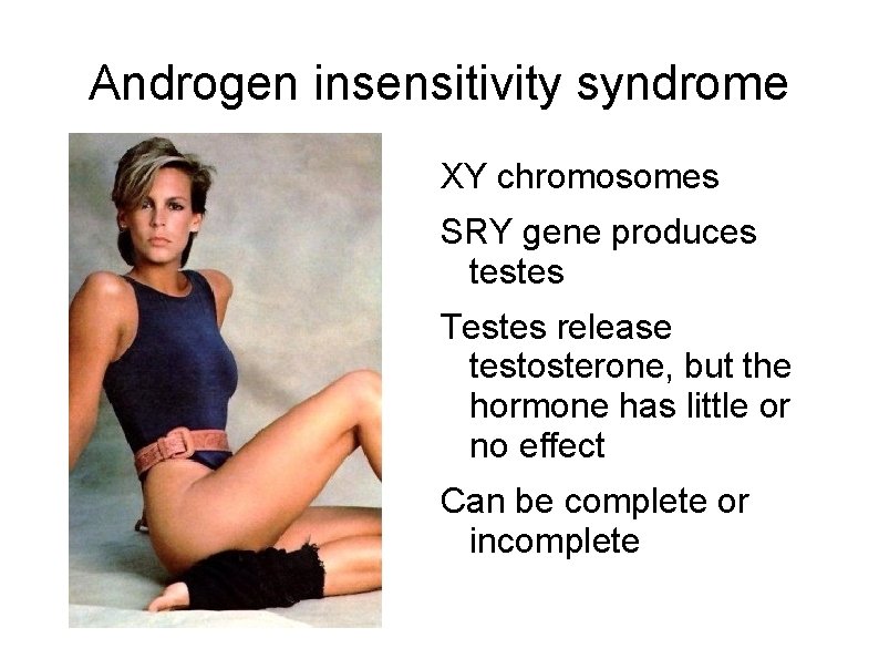 Androgen insensitivity syndrome XY chromosomes SRY gene produces testes Testes release testosterone, but the