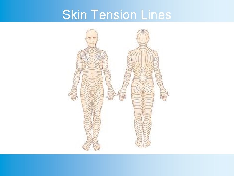 Skin Tension Lines 