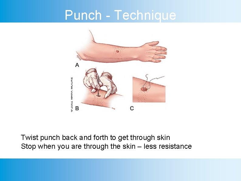 Punch - Technique Twist punch back and forth to get through skin Stop when