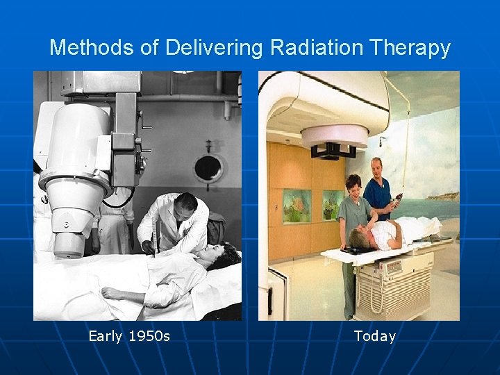 Methods of Delivering Radiation Therapy Early 1950 s Today 