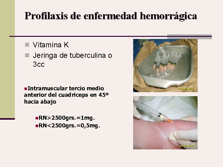 Profilaxis de enfermedad hemorrágica n Vitamina K n Jeringa de tuberculina o 3 cc