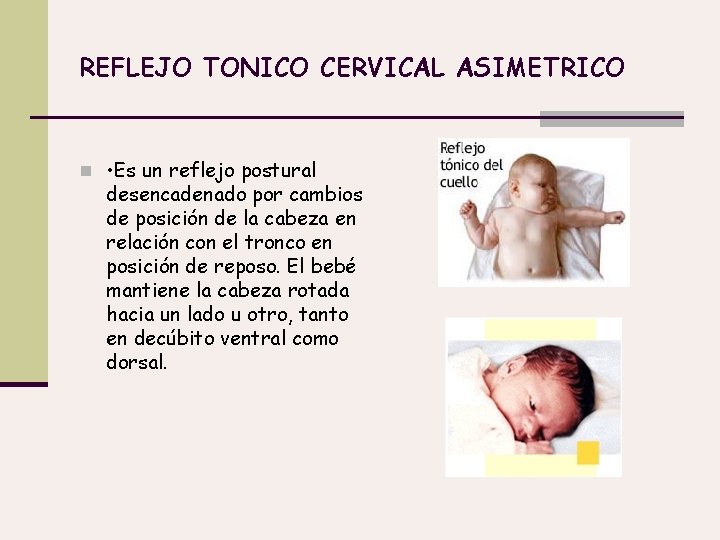 REFLEJO TONICO CERVICAL ASIMETRICO n • Es un reflejo postural desencadenado por cambios de