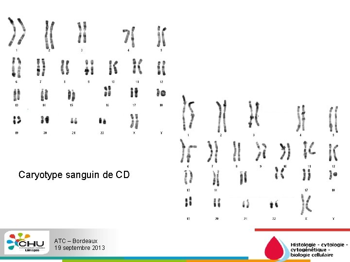 Caryotype sanguin de CD ATC – Bordeaux 19 septembre 2013 