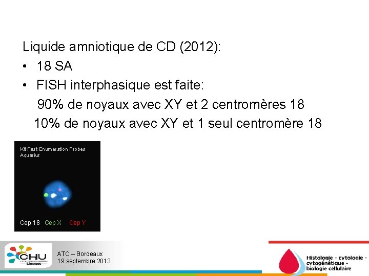 Liquide amniotique de CD (2012): • 18 SA • FISH interphasique est faite: 90%