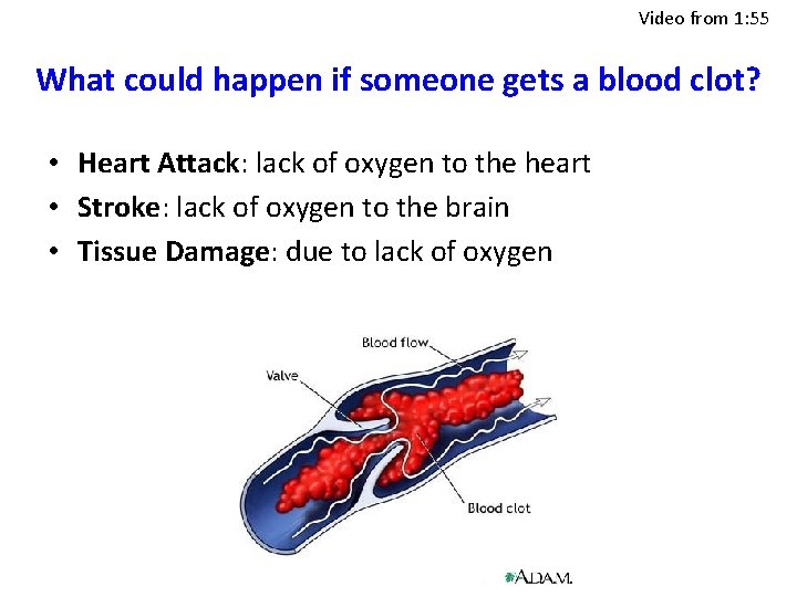 Video from 1: 55 What could happen if someone gets a blood clot? •
