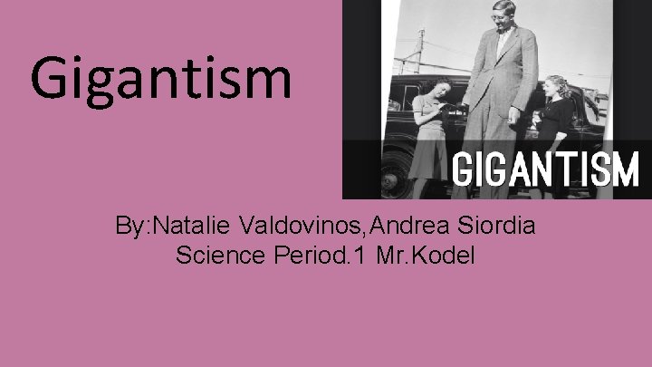 Gigantism By: Natalie Valdovinos, Andrea Siordia Science Period. 1 Mr. Kodel 