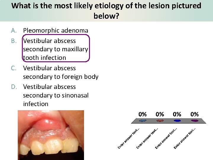 What is the most likely etiology of the lesion pictured below? A. Pleomorphic adenoma