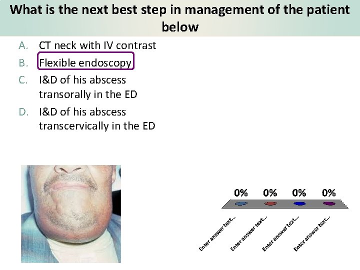 What is the next best step in management of the patient below A. CT