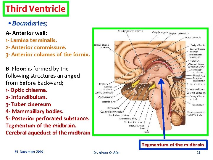 Third Ventricle • Boundaries; A- Anterior wall: 1 - Lamina terminalis. 2 - Anterior