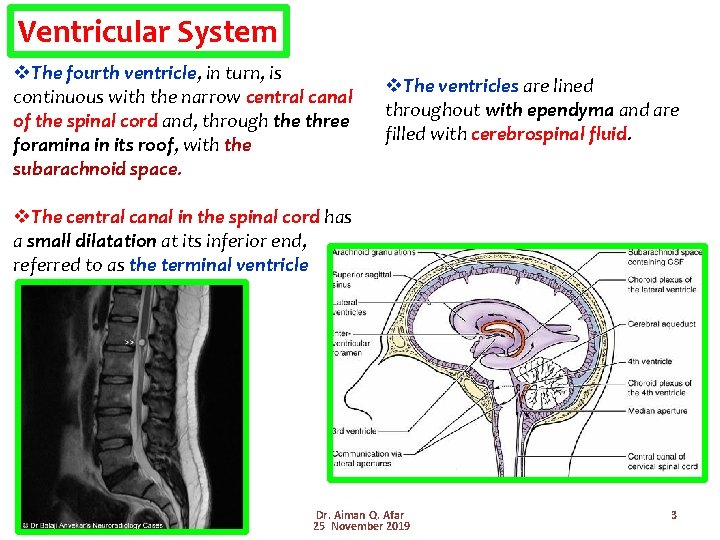 Ventricular System v. The fourth ventricle, in turn, is continuous with the narrow central