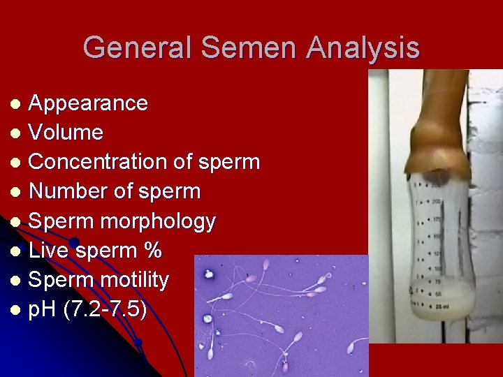 General Semen Analysis Appearance l Volume l Concentration of sperm l Number of sperm