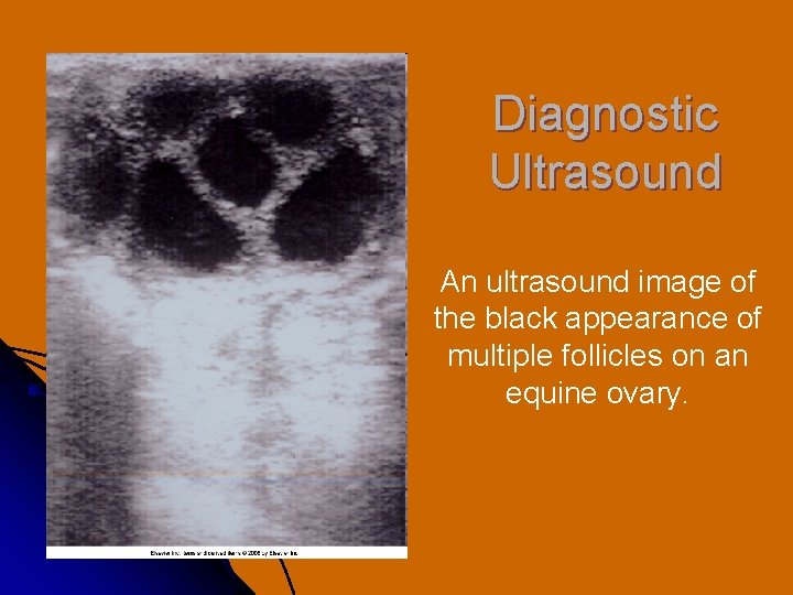 Diagnostic Ultrasound An ultrasound image of the black appearance of multiple follicles on an