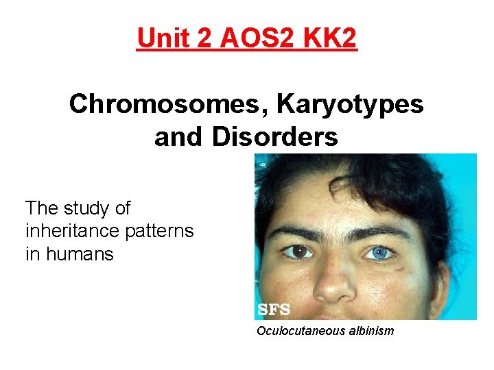 Unit 2 AOS 2 KK 2 Chromosomes, Karyotypes and Disorders The study of inheritance Unit 2 AOS 2 KK 2 Chromosomes, Karyotypes and Disorders The study of inheritance